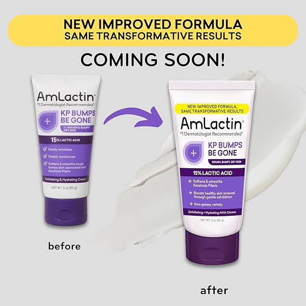 AMLACTIN KP BUMPS BE GONE – 3 OZ KERATOSIS PILARIS MOISTURIZING CREAM WITH 15% LACTIC ACID – EXFOLIATOR AND MOISTURIZER FOR DRY, ROUGH AND BUMPY SKIN (PACKAGING MAY VARY)