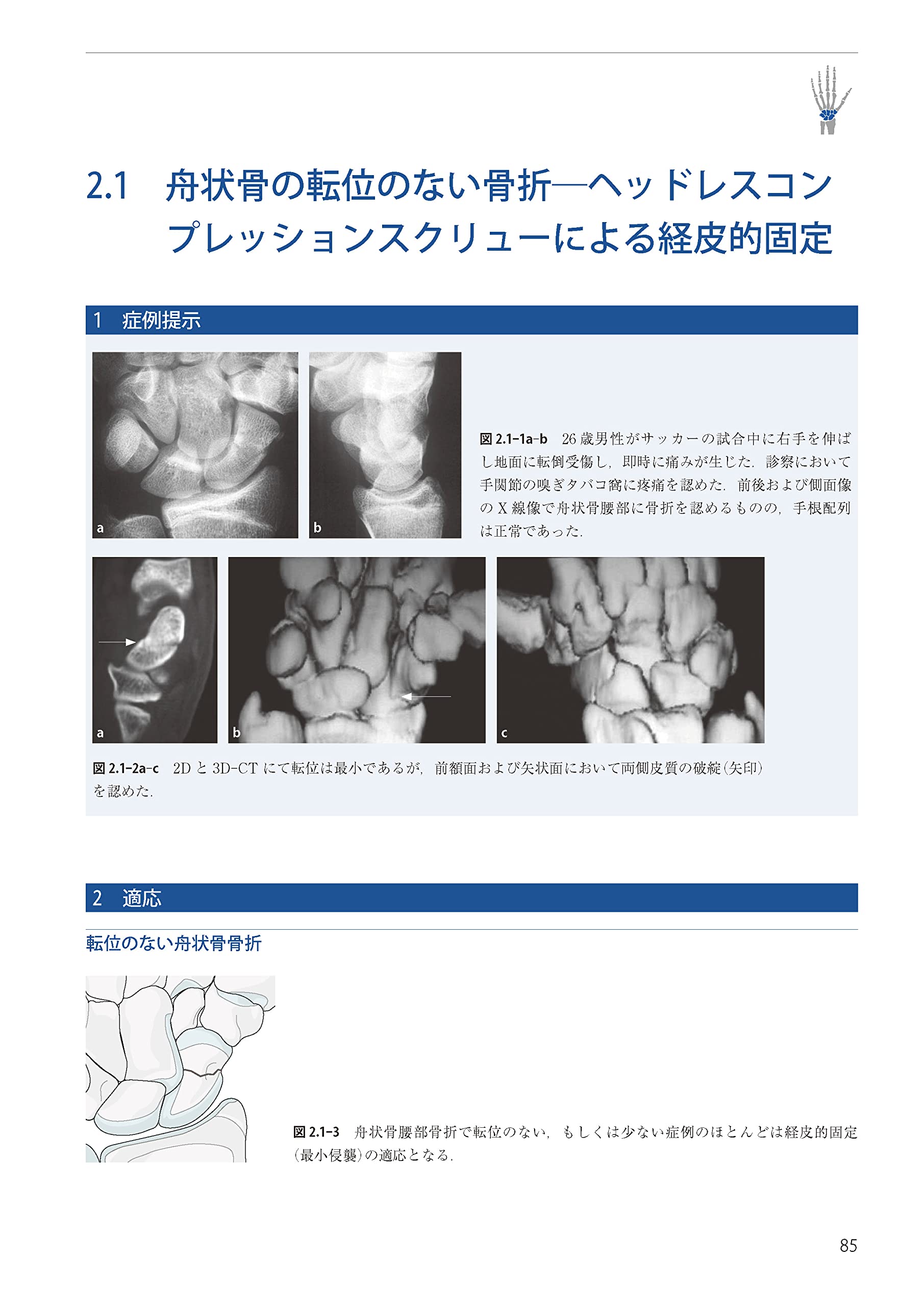 チリヨウ Ao法骨折治療 英語版web付録付 Richardebuckley Christophergmoran Bookfan Paypayモール店 通販 Paypayモール ばつくれ Shineray Com Br