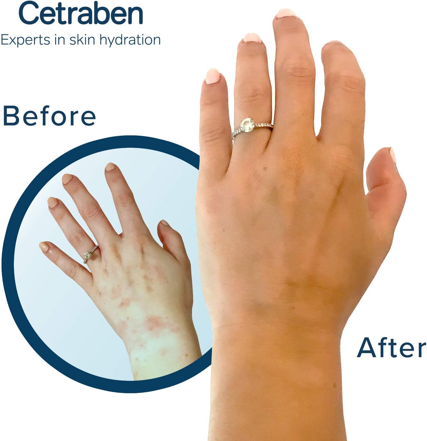 Cetraben Natural Oatmeal Cream, for Dry Sensitive & Eczema-Prone Skin, Provides 24 Hour Hydration, Soothing - Image 4