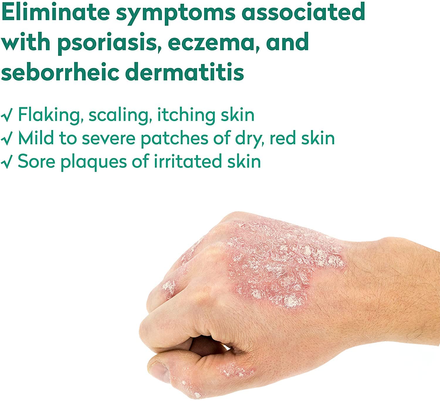 Dr. Blaine’s REVITADERM Psoriasis Formula - Topical Cream with Coal Tar, Tea Tree Oil and Lavender Oil for Itching, Flaking, Dry, Cracked Skin Relief - 4 fl. oz. - Includes Travel Size Bottle (2-Pack)