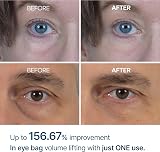 DR.MELAXIN Eyephalt Eye Cream 10g Under Eye Bags Puffiness Niacinamide view 3
