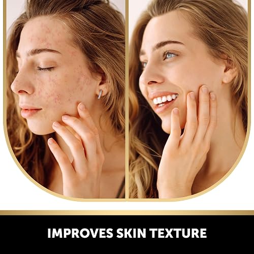 kojic acid soap glutathione collagen vitamin c Natural Antioxidant Tumeric Vit Dark Spot 733739001757| eBay The natural active ingredients of the brightening soap will help to build illuminated and glowing skin Kojic Acid Vitamin C and