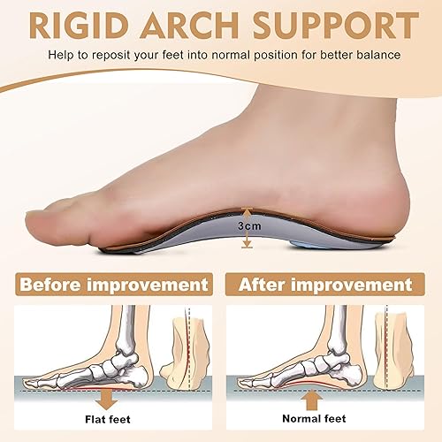 Foot Pain Relief Top Insoles For Flat Feet Orthotic Insoles For
