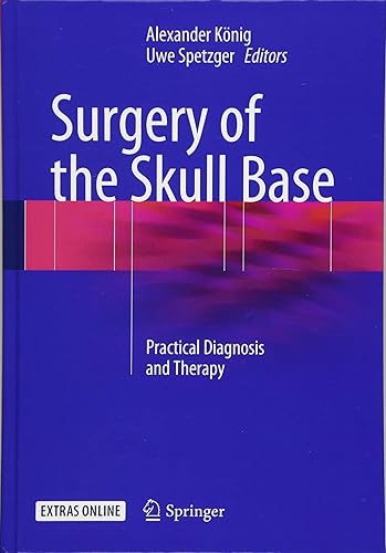 Download Schädelbasischirurgie: Practical Diagnosis and Therapy PDF