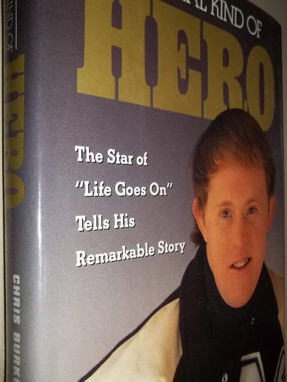 A Special Kind Of Hero The Star Of Life Goes On Tells His Remarkable Story Burke Chris Amazon Com Books