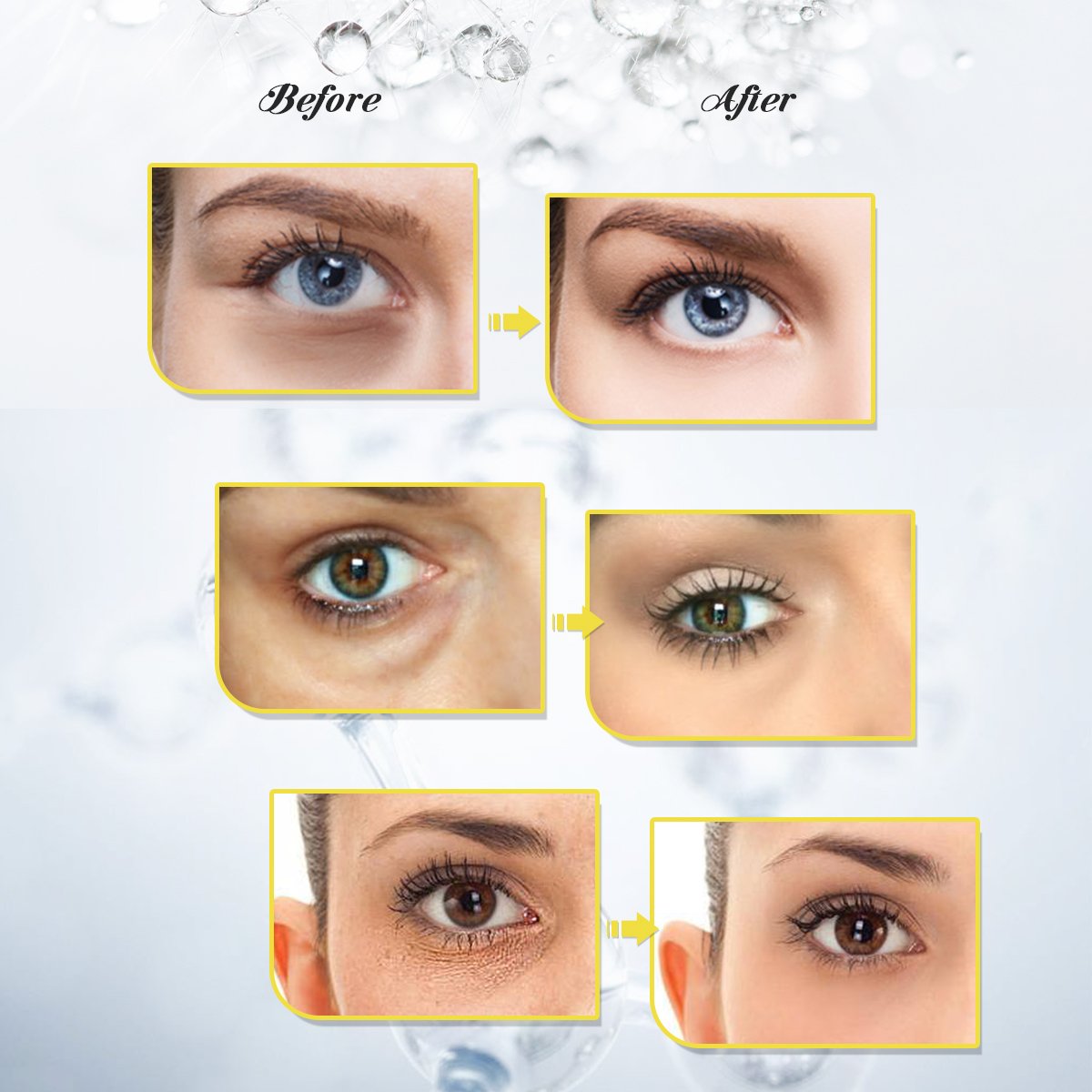 Eye Mask, Eye Treatment Masks, Collagen Eye Pads, LuckyFine Collagen Eye Mask for Anti Aging, Dark Circles and Puffiness, Anti Wrinkle, Moisturizing, Whitening 10 Pairs