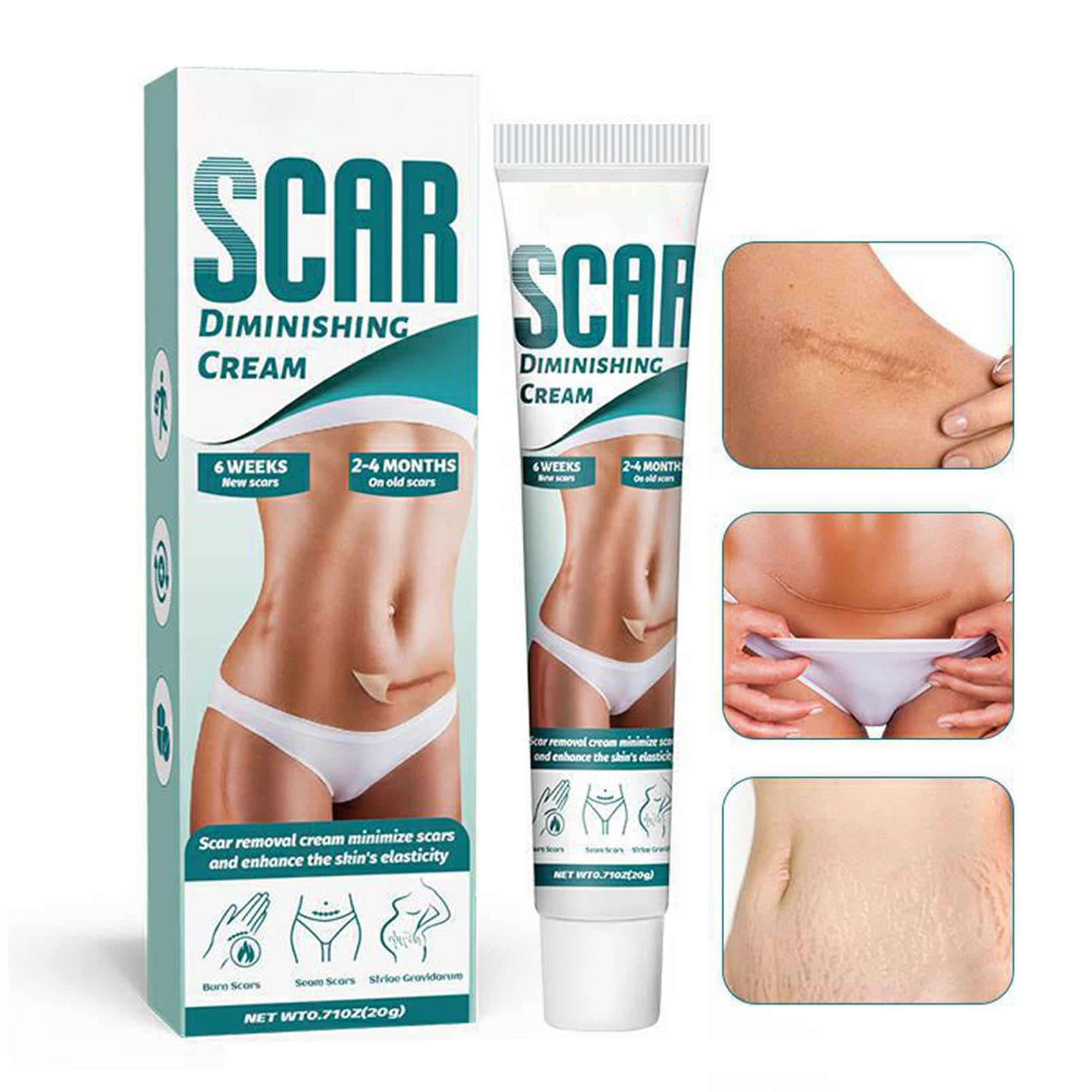 Scar Cream, Scar Removal Cream, Stretch Mark Removal Cream, Scar Erase, Skin Care for Cream for Face & Body Scar, for C-Section, Burns, Stretch Marks, Blemishes,Effective for Both Old and New Scars