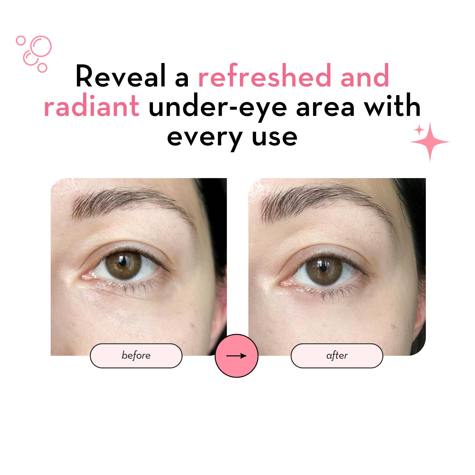 Elizabeth Mott 24K Gold Under Eye Patches - Collagen, Niacinamide & Peptides for Puffy Eyes, Dark Circles & Wrinkles - Hydrating & Brightening Eye Mask, Cruelty-Free