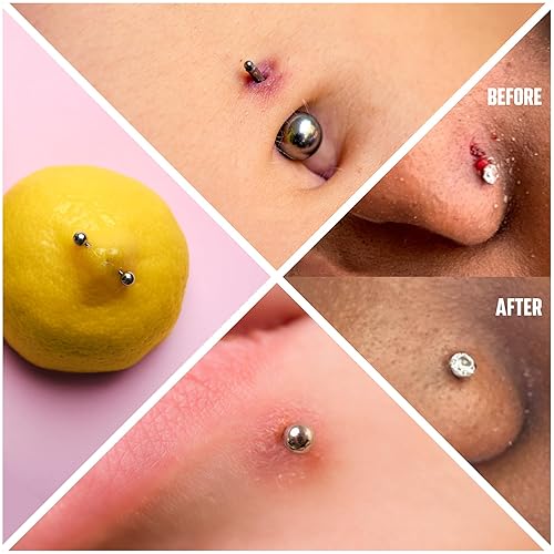 Allergic Reaction Itchy Navel Piercing Premium Hypoallergenic