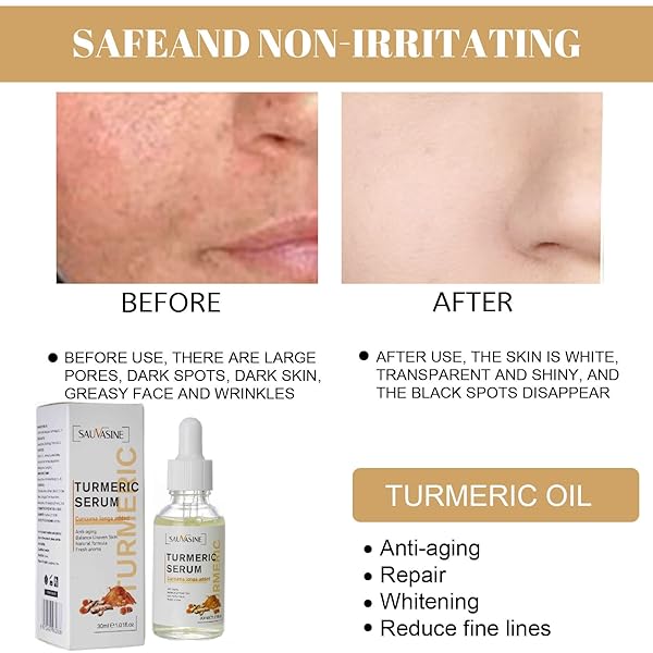 2022 NEW TURMERIC DARK SPOT CORRECTOR SERUM, TURMERIC REPAIR FACE SERUM, BRIGHT SKIN DARK SPOT SKIN CARE MOISTURIZING REPAIR SERUM. 30ML