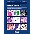 Thoracic Tumours: WHO Classification of Tumours