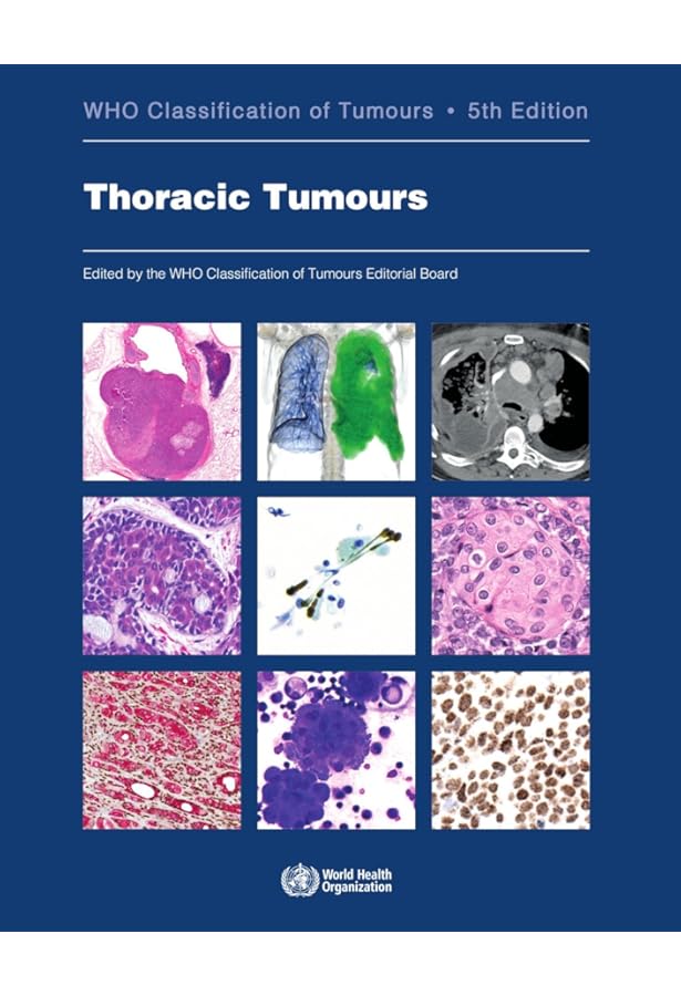 WHO Classification of Tumours of Haematopoietic and Lymphoid