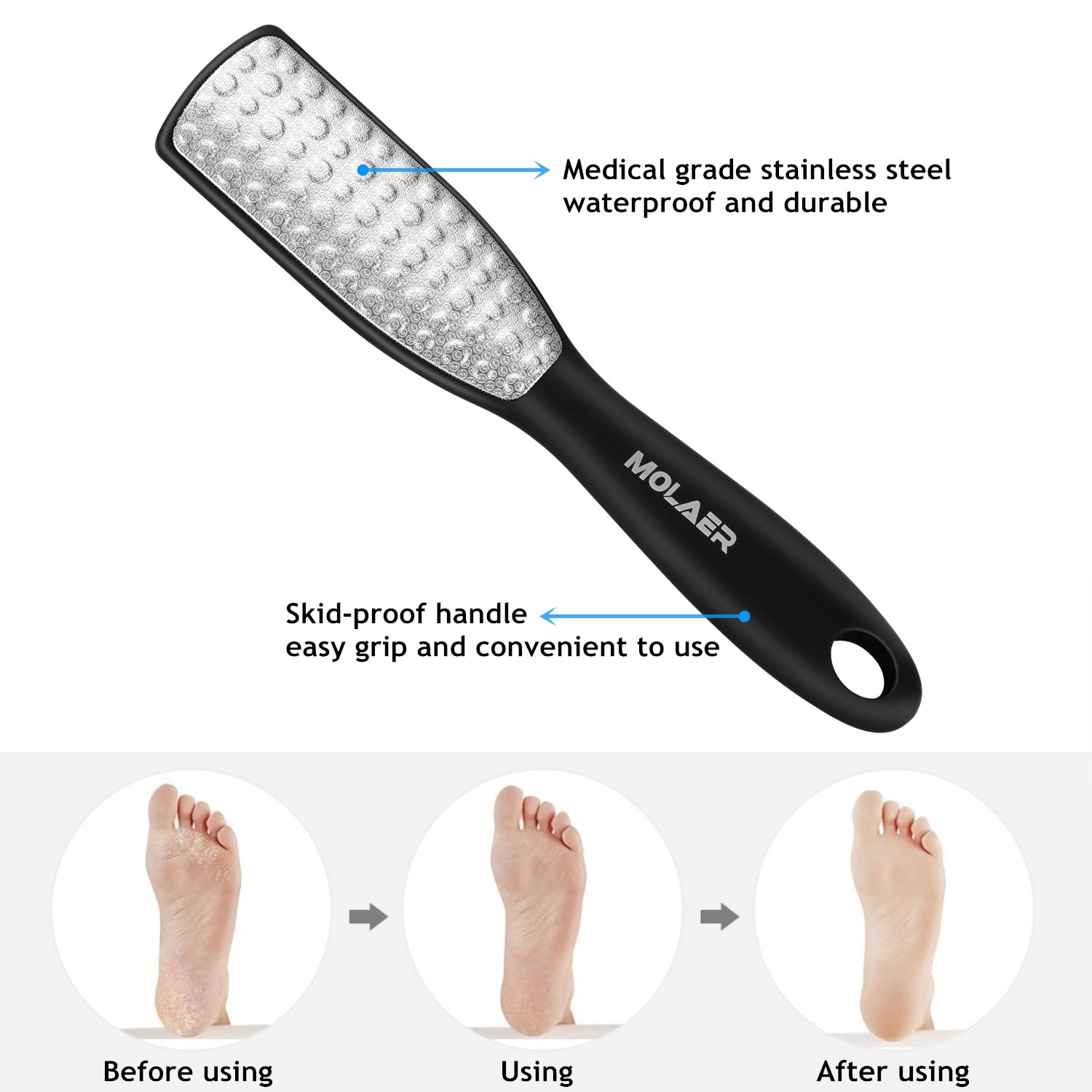 Foot File, 2-Sided Callus Remover, MOLAER Hypoallergenic Foot Care Pedicure Tool to Remove Dead Skin, Stainless Steel Surface, Used on Both Wet and Dry Feet : Beauty
