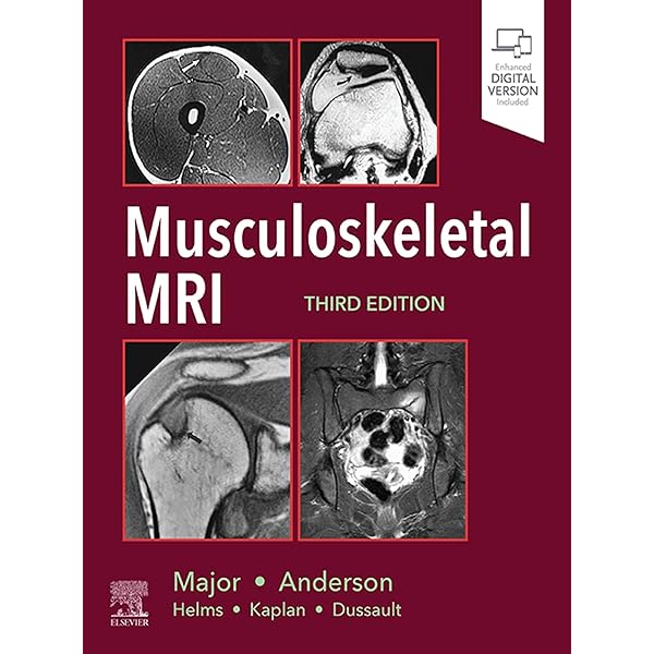 AMIRSYS Diagnostic Imaging Orthopaedics 2004 Stoller・TirmanBredella 043LaD diagnosticimagin0000stol