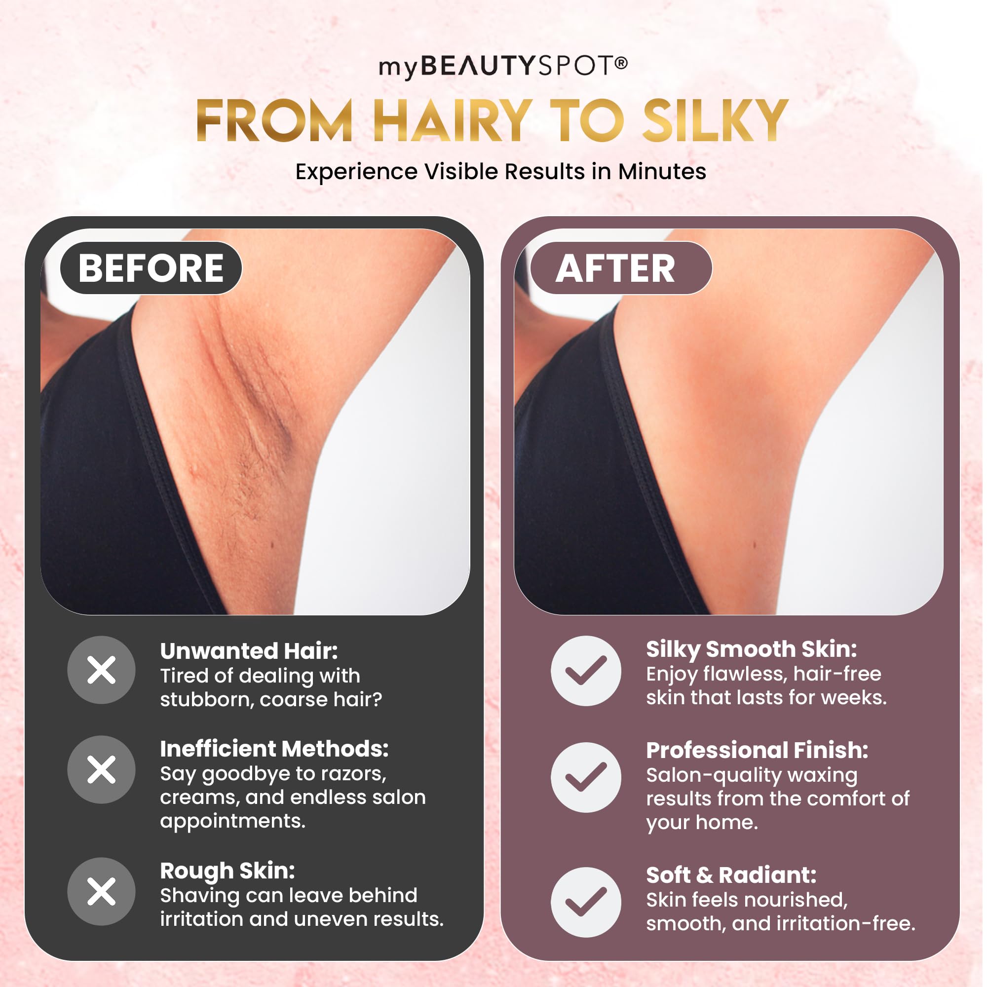 My Beauty Spot Waxing Kit for Women – At-Home Wax Machine for Hair Removal with Hard Honey Wax Beads, Warmer Pot & Applicators – Full Body & Bikini Use, Exfoliating & Hydrating Formula