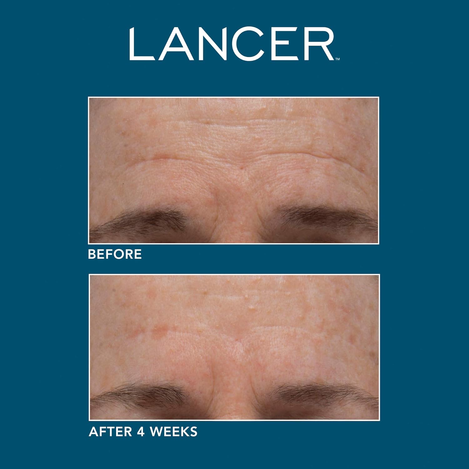 dr lancer the method