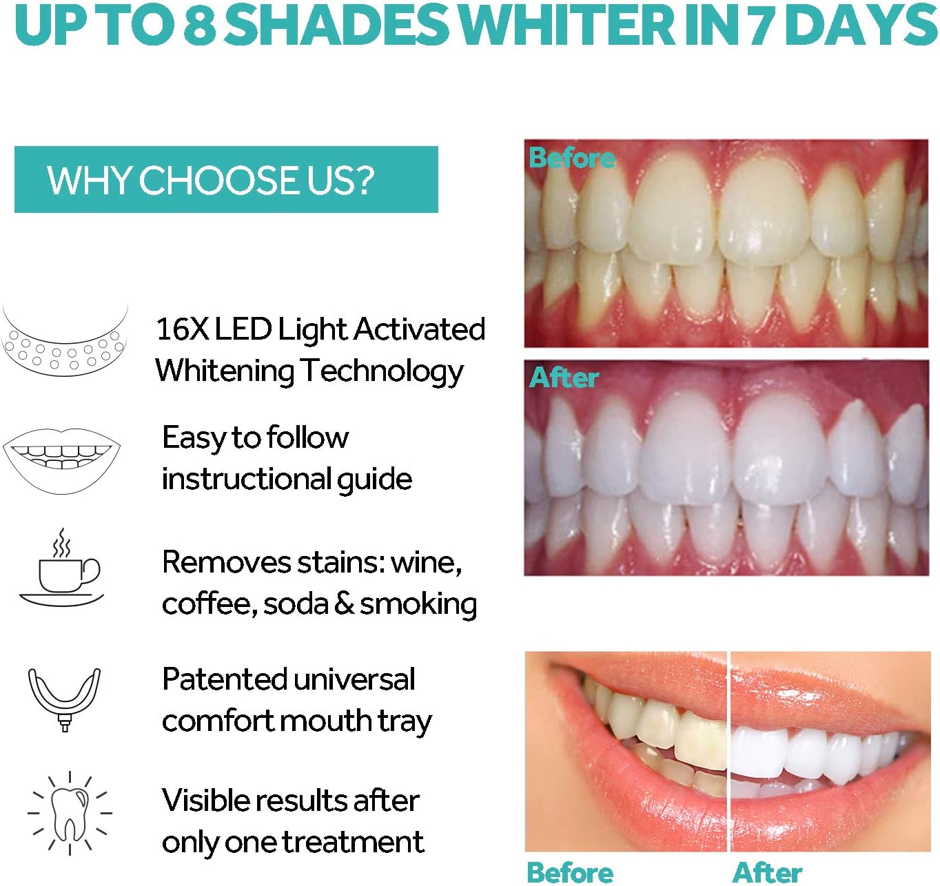 Teeth Whitening Light, PHOEBE New Upgrade 16 LED Teeth Whitening Accelerator Light Mouth Tray Teeth Whitening Enhancer Light Trays Connected with iPhone/Android/Type-C for Home Use: Health & Personal Care