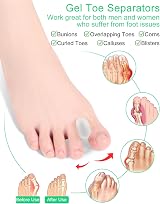 PGRODE 12 Pack Gel Toe Separators 6S 6L Soft Silicone Bunion Spacers view 5