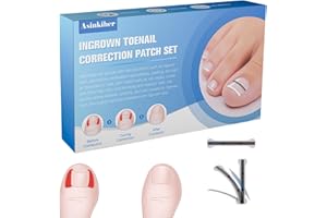 Titanium Alloy Ingrown Toenail Treatment, Ingrown Toenail Removal Kit for Curved Nail Repair, Ingrown Nail Tool for Home Use 