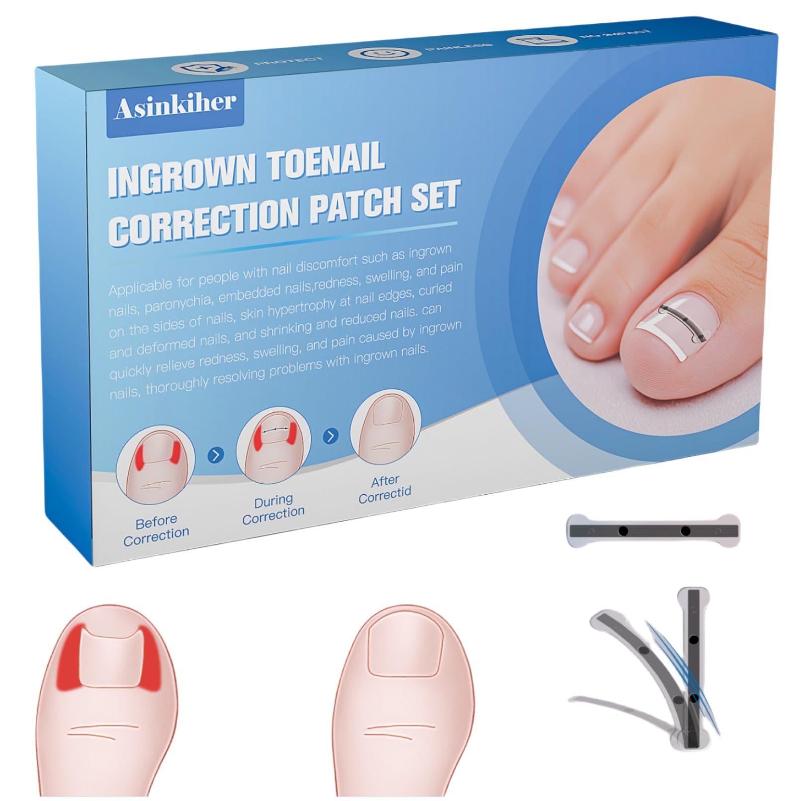 Photo 1 of Titanium Alloy Ingrown Toenail Treatment, Ingrown Toenail Removal Kit for Curved Nail Repair, Ingrown Nail Tool for Home Use