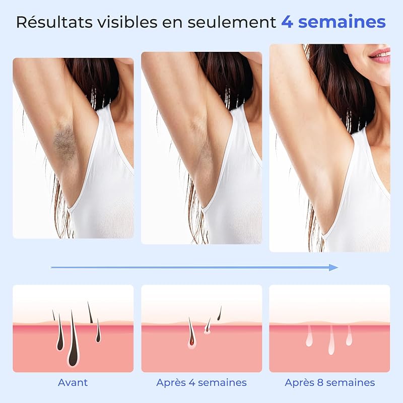 21J Épilateur Lumière Pulsée, IPL Épilateur Laser avec Fonction de Refroidissement, Salon à la Maison,9 Niveaux Laser Epilation pour Femme et Homme, Corps Aisselles, Blanc