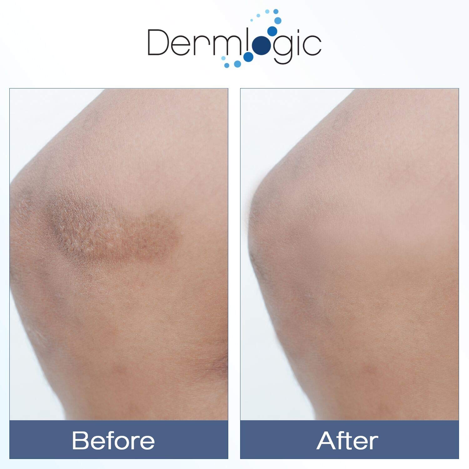 dermlogic vitamin k cream