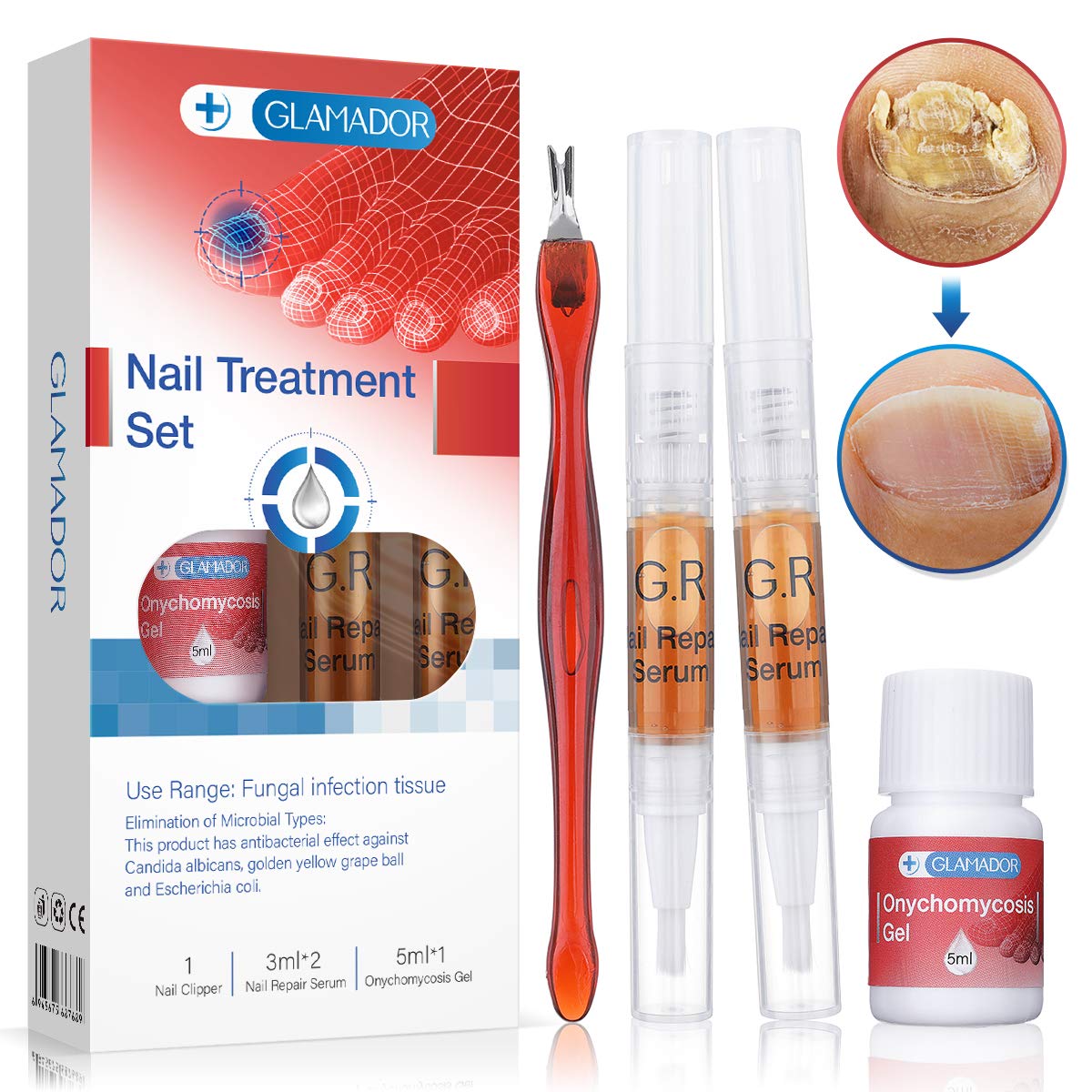 Nail Repair Pen, GLAMADOR Effective Nail Treatment Set, Toenail and Nail Care Solution, Strengthen and Repairs Damaged Brittle Nails, 2 Pens included : Beauty