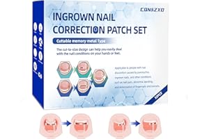 CQN&ZXD Customizable Memory Alloy Ingrown Toenail Treatment Patch, 10 PCS Home Ingrown Toenail Corrector, Designed for Curved and Multi-Size Nails Ingrown Toenail Removal Kit, Nail Repair for Finger and Foot