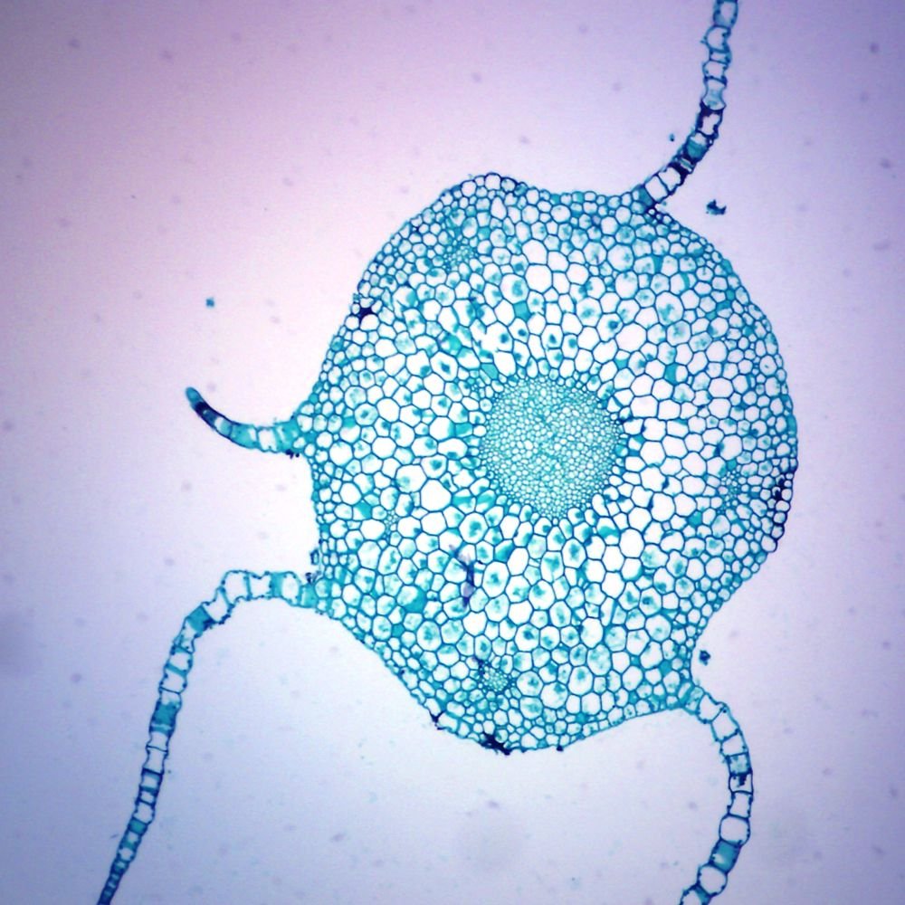 Moss Gametophyte Under A Microscope Micropedia