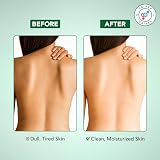 Botanic Hearth Tea Tree Body Wash 473 ml – Deep Cleanse Moisturize view 4