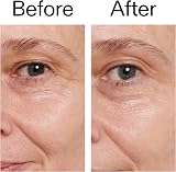 The INKEY List Retinol Eye Cream 15ml - Night Cream for Under Eyes view 6