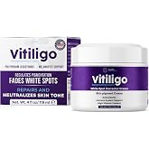 Vitiligo Cream for White Spots (4oz) - Repigmenting Cream with Polypodium Leucotomos and Melanocyte Support - Evens Skin Tone and Reduces Discoloration by Aura Dermacare