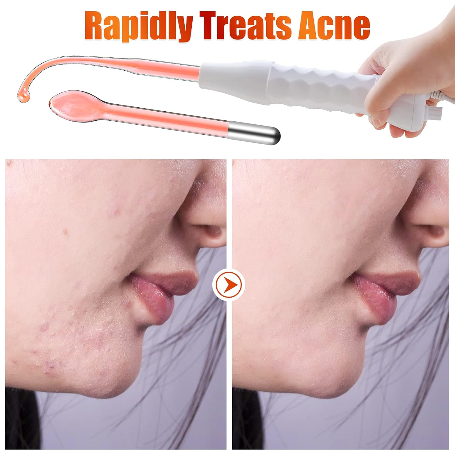 High Frequency Machine, AMDAILY Portable Handheld High Frequency Facial Wand w/Neon for Personal Beauty Acne Spot Wrinkles Remover Eyes Body Care Hair Follicle Stimulator 4-in-1: Beauty