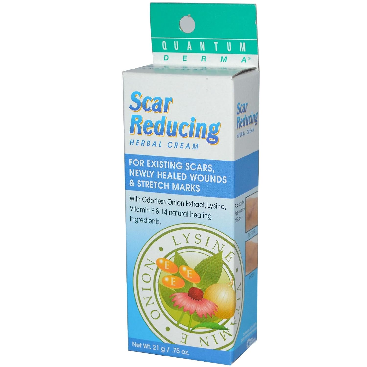 Quantum Scar Reducing Herbal Cream -- 0.75 oz : Scar Reducing Treatments : Beauty