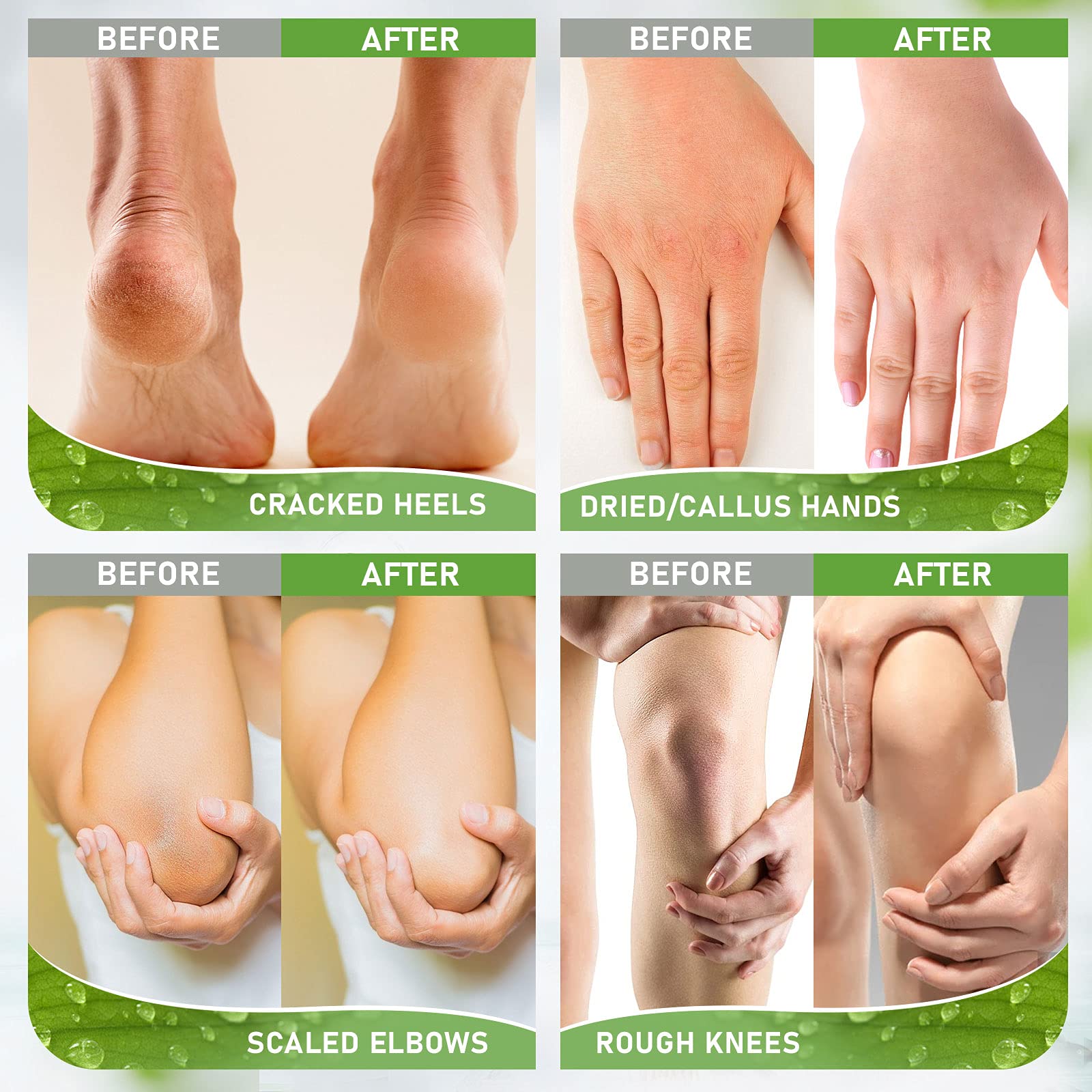 Urea Cream 42% - 2% Salicylic Acid Foot Moisturizer - Callus & Dead Skin Remover, Repairing Foot File, 3.5 oz