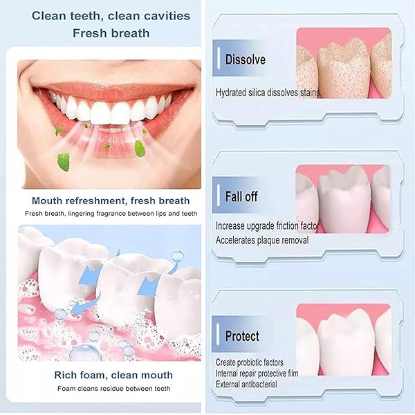 TWWKDD 120G YAYASHI SP-4 TOOTHPASTE, YILIKU SP-4 PROBIOTIC TOOTHPASTE, SP-4 BRIGHTENING TOOTHPASTE FRESH BREATH TOOTHPASTE, SP-4 BRIGHTENING & STAIN REMOVING TOOTHPASTED