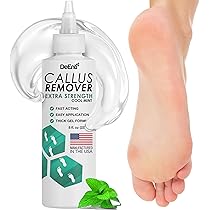 Electric Foot Callus Remover, Pain-Free Electric Callus