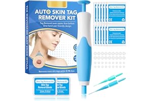 Standard Skin Tag Tool Kit - Quick Solution for Medium to Large Tags (2mm-8mm) With 40 Removal Bands & 10 Cleansing Wipes - C