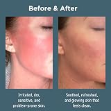 Sea Magik Tea Tree Face Wash for Acne Prone Skin 150ml Vegan Cruelty Free view 3