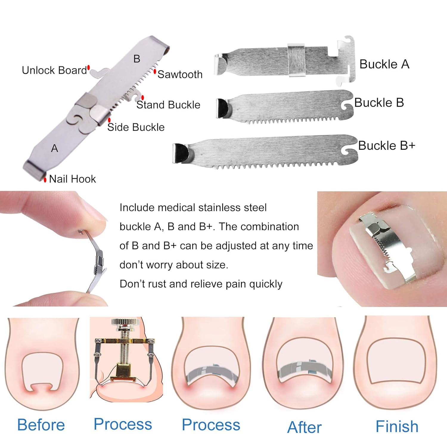 Ingrown Toenail Tool, 47 Pieces Ingrown Toenail Corrector and Lifter Toe Nail Correction Buckle Kit With Sticker for Professional Treatment (M): Beauty