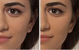 L'Oreal Paris True Match The One Concealer 4N Beige Pack of 2 6.8ml view 3