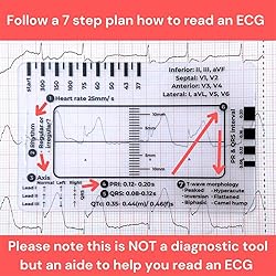 ECG 7 Step Ruler, ECG/EKG 7 Step Ruler Card for