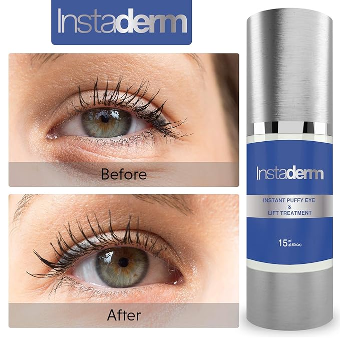 under eye bag removal cream