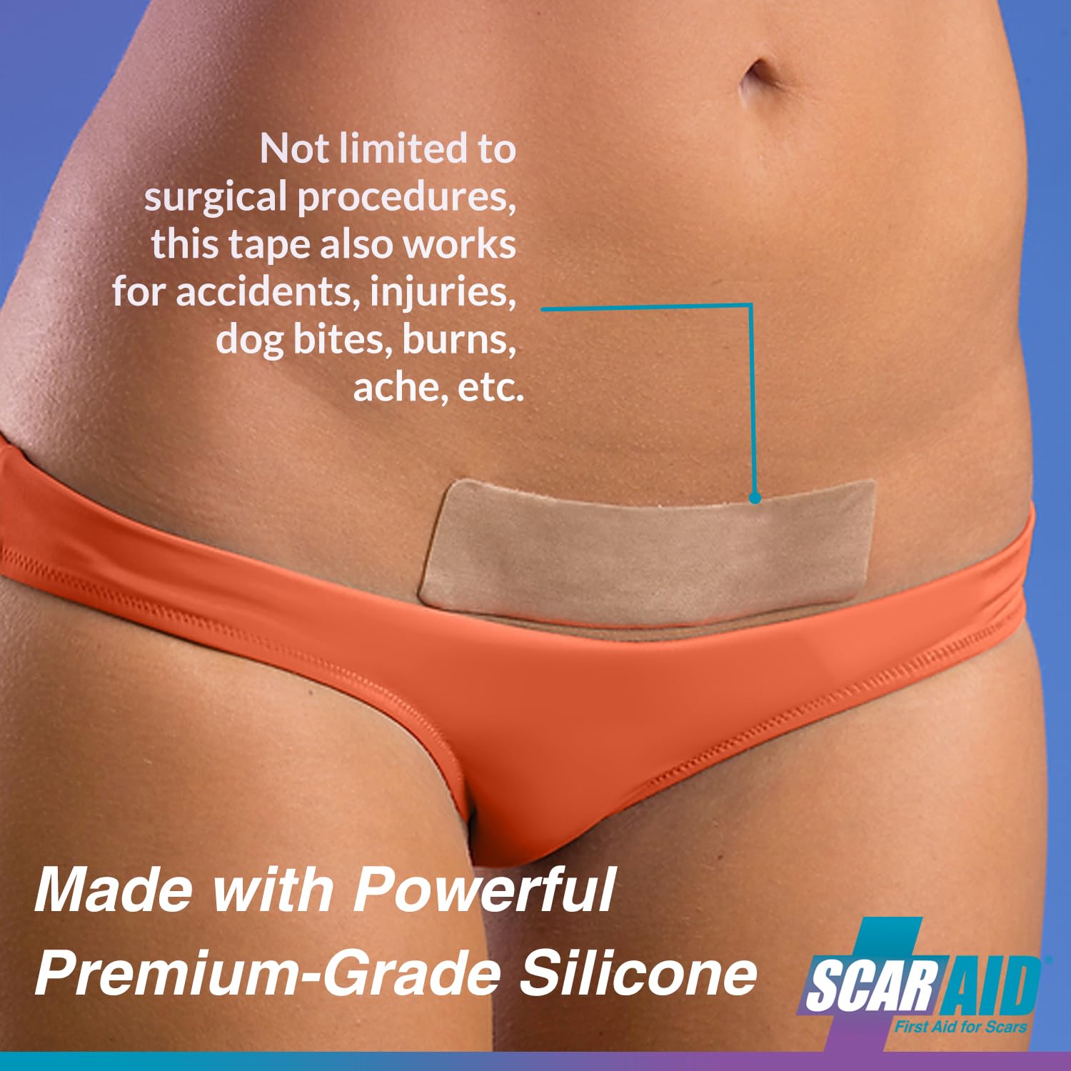 Custom-Fit Silicone Scar Tape – Washable & Reusable Silicone Tape for C Section, Keloid, Mastectomy, Acne, Surgical Scars & More - Flexible, Breathable & Gentle on All Skin Types – 1.5