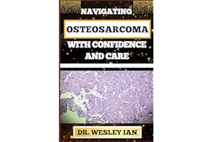 NAVIGATING OSTEOSARCOMA WITH CONFIDENCE AND CARE: Mastering The Journey And Embracing Change For Confronting Cancer For Holis