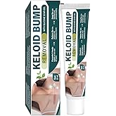 Keloid Bump Removal, Scar Removal for Surgical Marks & Burns, Gentle Effective Keloid Scar Treatment for Face and Body Healing