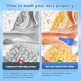 Qimic Ear Wax Removal Kit Ear Cleaner with 10 Tips Complete Home Kit view 4