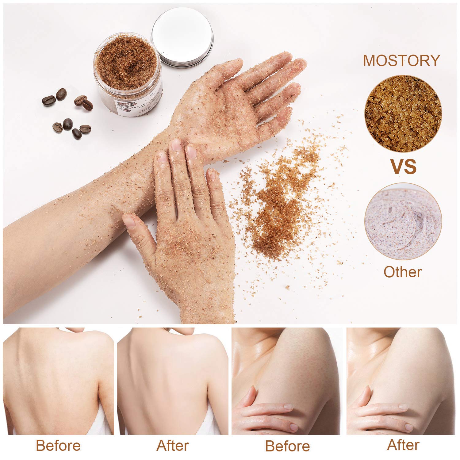 Exfoliating Dead Sea Salt Body Scrub - Arabica Coffee Organic Natural Scrubing Moisturizing Foot Leg Soft Scrubs For Women Men Cellulite Exfoliator Anti-Acne Wrinkles Vitamin E Hyaluronic Acid Coconut Oil 10 oz : Beauty