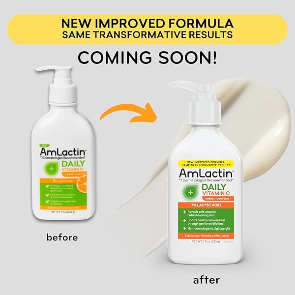 AMLACTIN DAILY VITAMIN C LOTION – 7.9 OZ BODY LOTION WITH 7% LACTIC ACID – SKIN-BRIGHTENING EXFOLIATOR AND MOISTURIZER FOR DRY SKIN