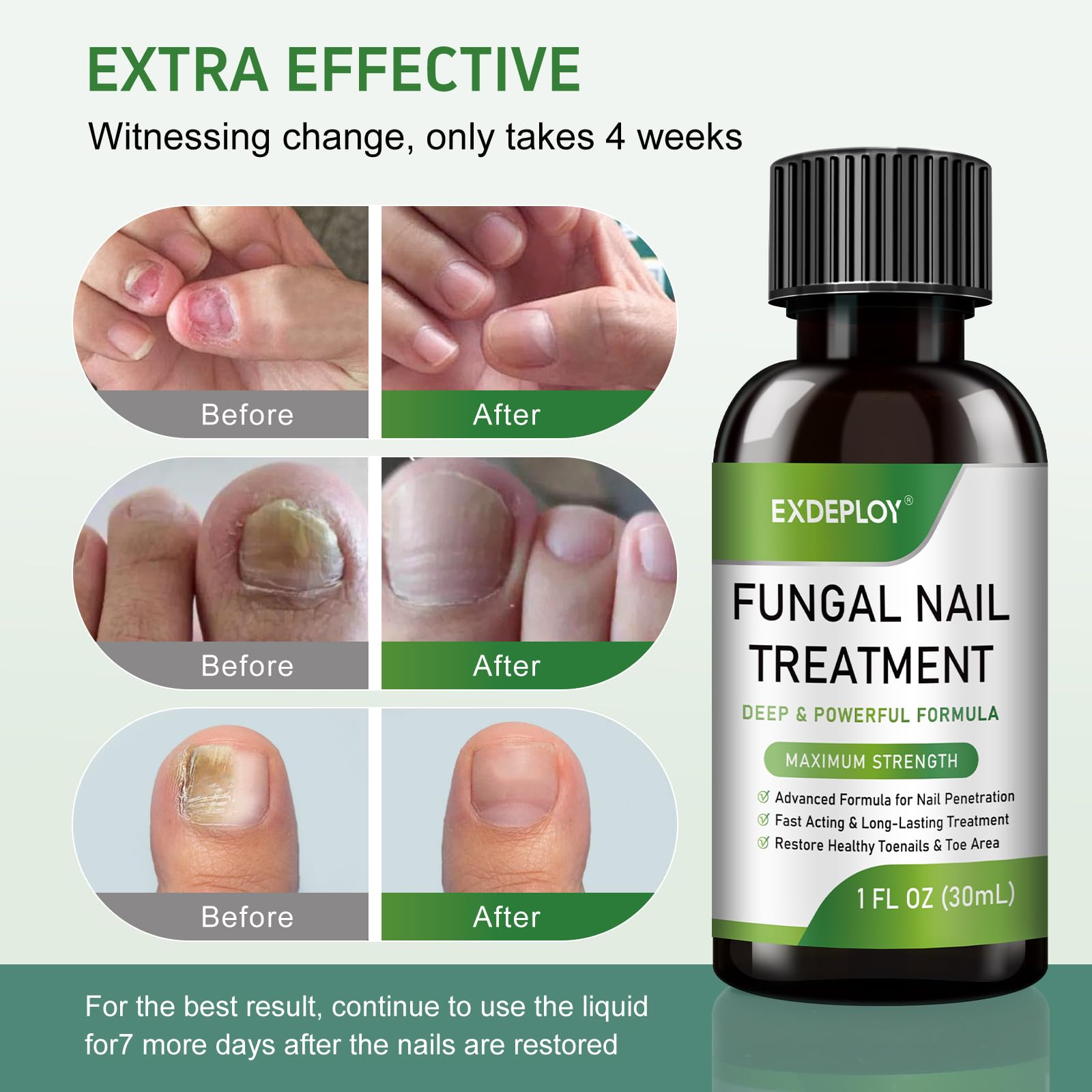 6 Pack Toenail Fungus Treatment Extra Strength with 25% Undecylenic Acid for Toenails and Fingernails with Natural Oils for Thick, Damaged & Nails foot fungus treatment extra strength - Image 4